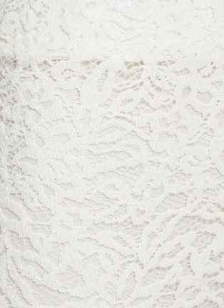  - EPINGLER - Jacquard Lace Shorts