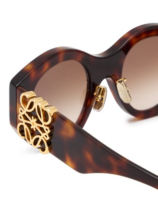 细节 - 点击放大 - LOEWE - Anagram Acetate Round Sunglasses