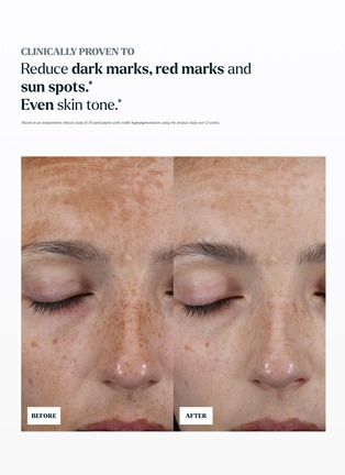细节 -点击放大 - SKIN ROCKS - The Hyperpigmentation Serum 30ml